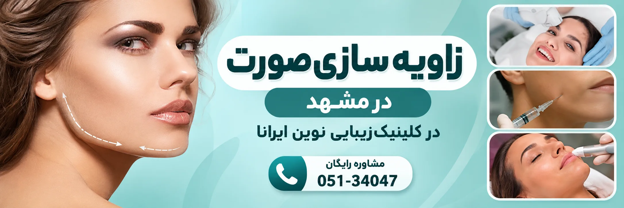 زاویه سازی صورت در کلینیک نوین ایرانا